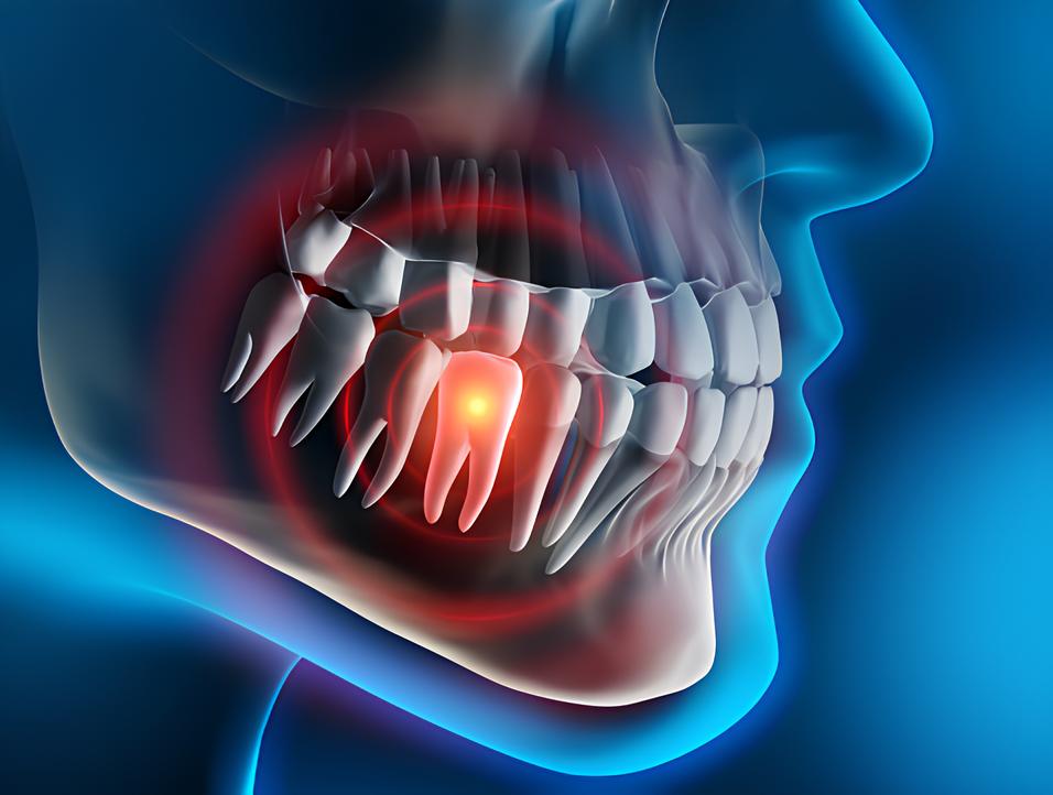 Teeth image - Emergency dentist East Grinstead